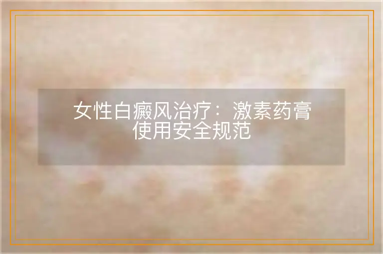 女性白癜风治疗:激素药膏使用安全规范