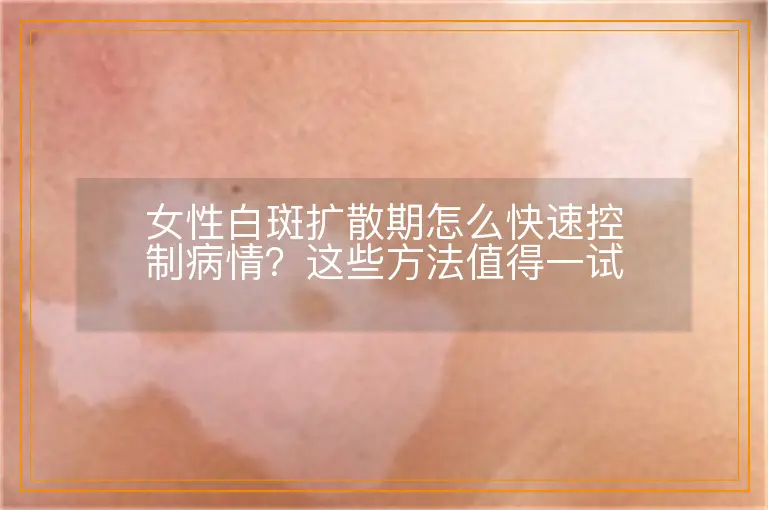 女性白斑扩散期怎么快速控制病情？这些方法值得一试