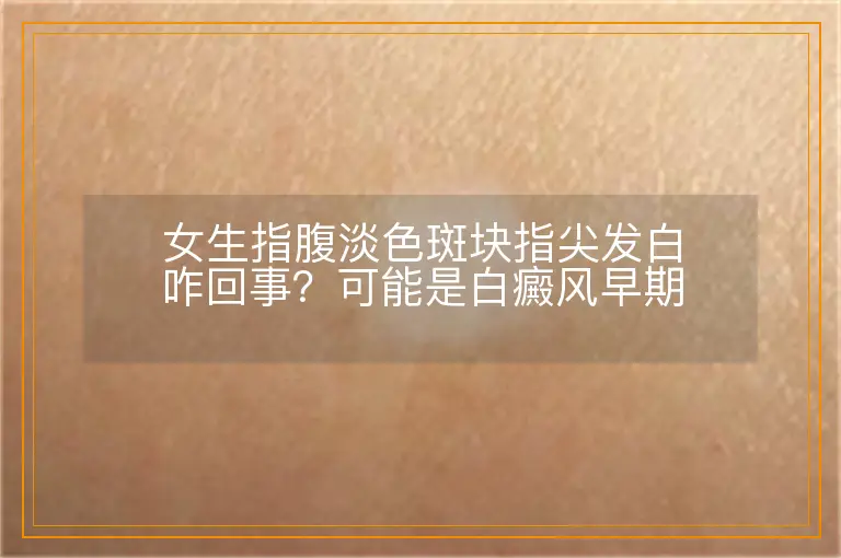 女生指腹淡色斑块指尖发白咋回事?可能是白癜风早期信号