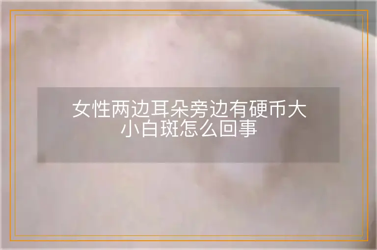 女性两边耳朵旁边有硬币大小白斑怎么回事
