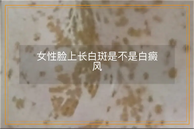 女性脸上长白斑是不是白癜风