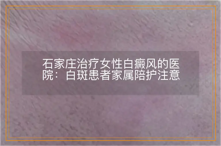 石家庄治疗女性白癜风的医院：白斑患者家属陪护注意事项