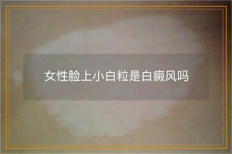 女性脸上小白粒是白癜风吗