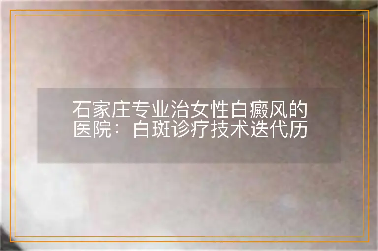 石家庄专业治女性白癜风的医院:白斑诊疗技术迭代历程
