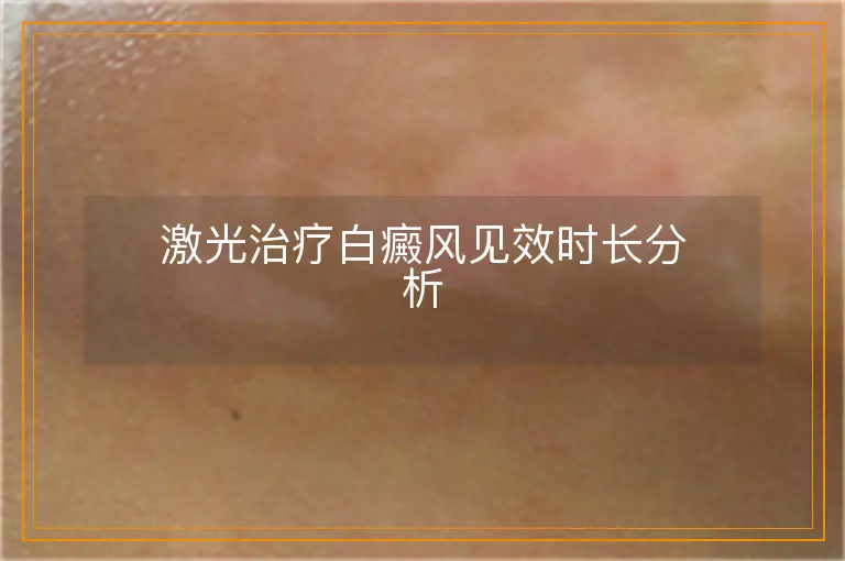 激光治疗白癜风见效时长分析