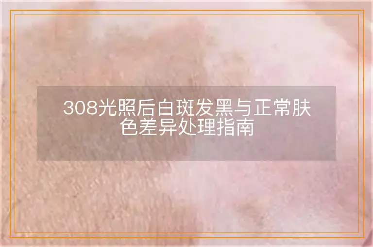 308光照后白斑发黑与正常肤色差异处理指南