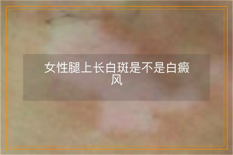 女性腿上长白斑是不是白癜风
