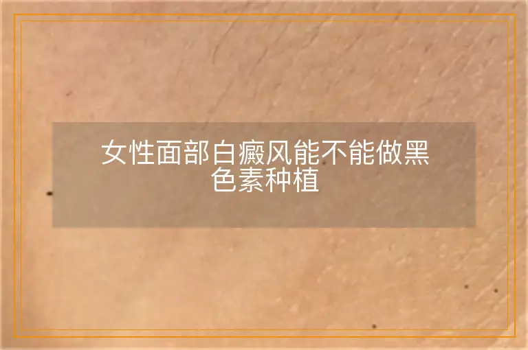 女性面部白癜风能不能做黑色素种植