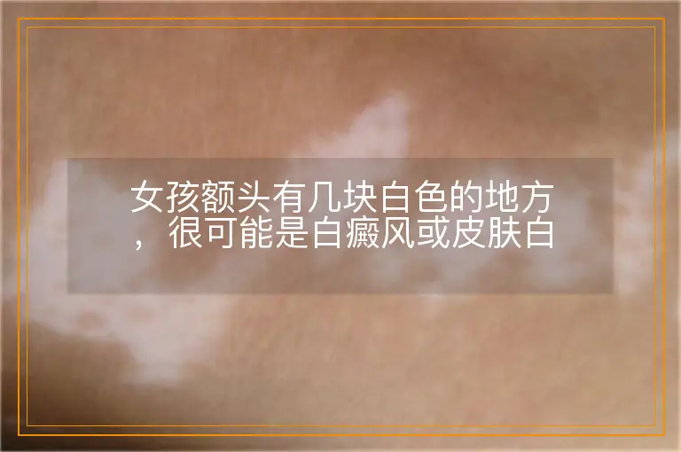 女孩额头有几块白色的地方,很可能是白癜风或皮肤白斑问题,需要及时关注