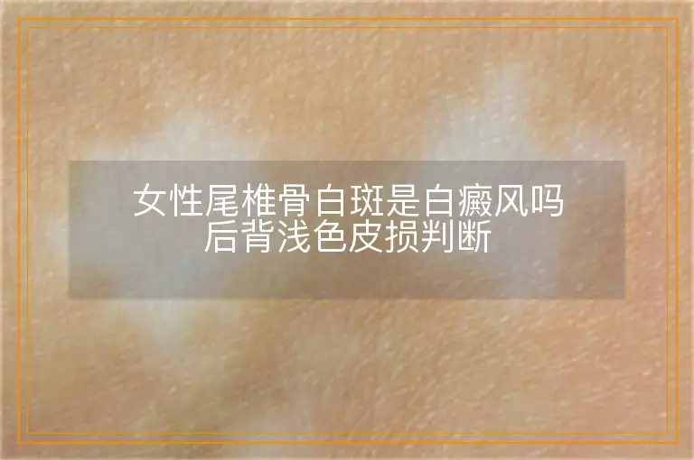 女性尾椎骨白斑是白癜风吗后背浅色皮损判断