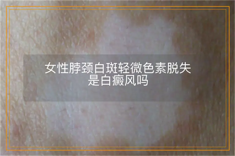 女性脖颈白斑轻微色素脱失是白癜风吗