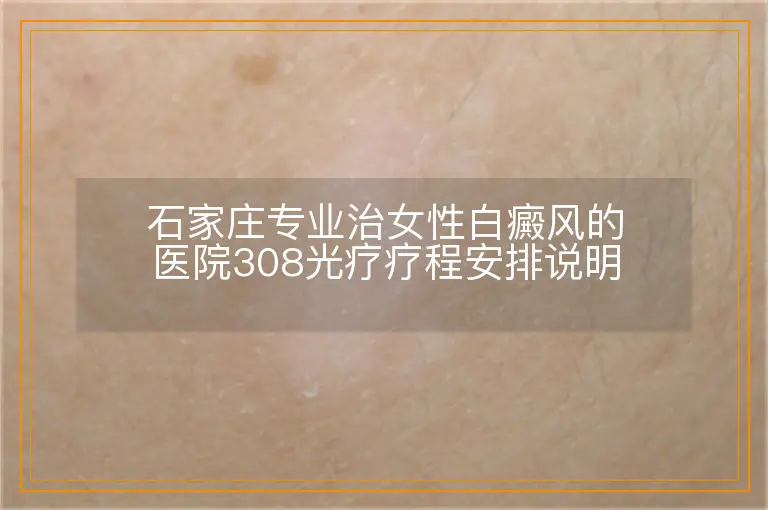 石家庄专业治女性白癜风的医院308光疗疗程安排说明