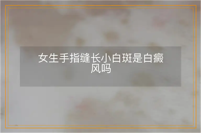 女生手指缝长小白斑是白癜风吗