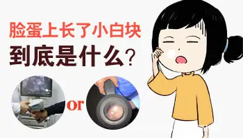 孕妇白癜风怎么护理好呢