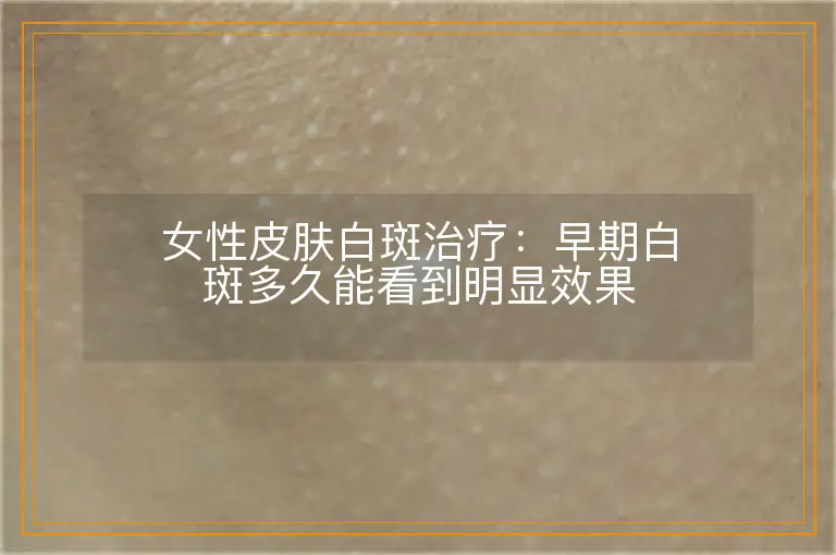 女性皮肤白斑治疗：早期白斑多久能看到明显效果