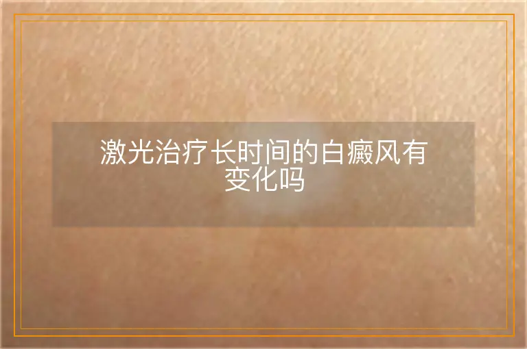 激光治疗长时间的白癜风有变化吗