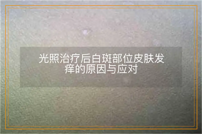 光照治疗后白斑部位皮肤发痒的原因与应对