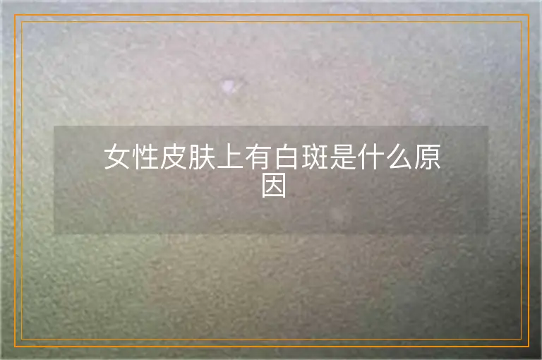 女性皮肤上有白斑是什么原因