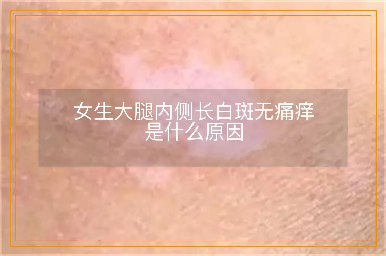女生大腿内侧长白斑无痛痒是什么原因