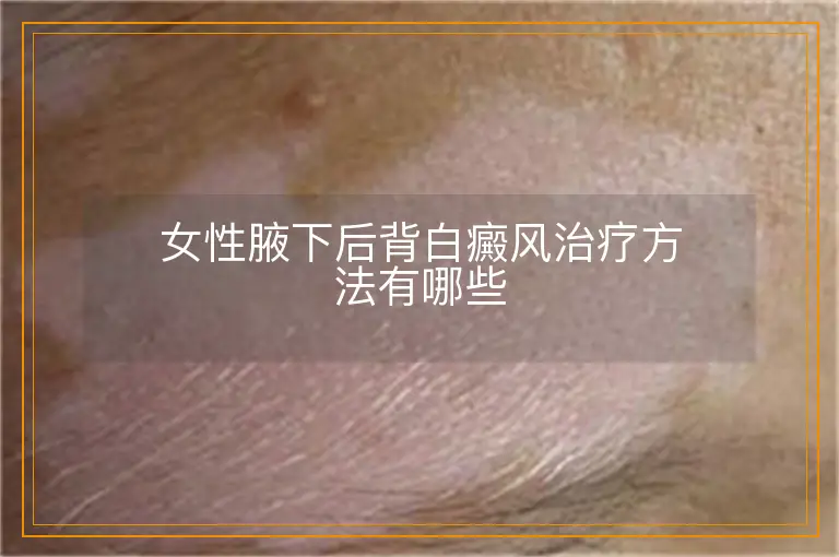 女性腋下后背白癜风治疗方法有哪些