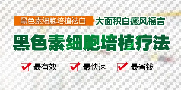 什么样的人会比较容易得白癜风
