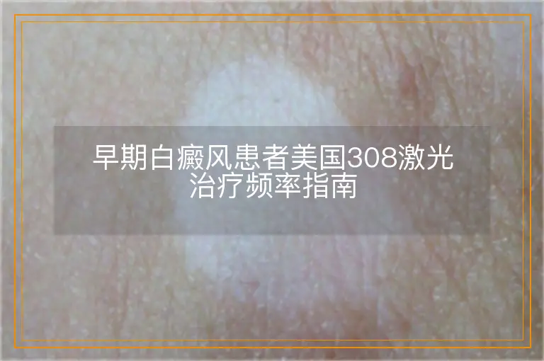 早期白癜风患者美国308激光治疗频率指南