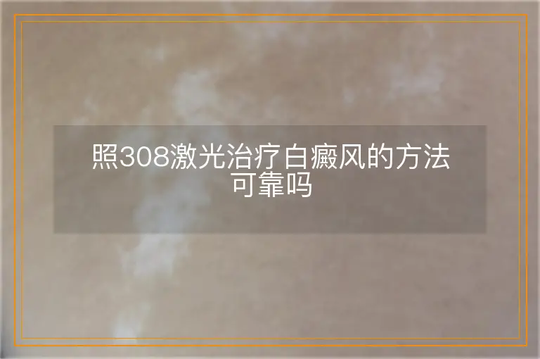 照308激光治疗白癜风的方法可靠吗