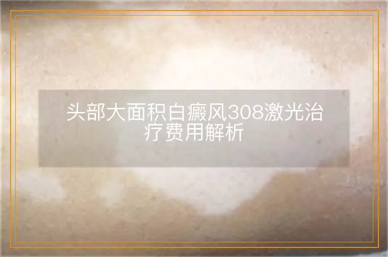 头部大面积白癜风308激光治疗费用解析