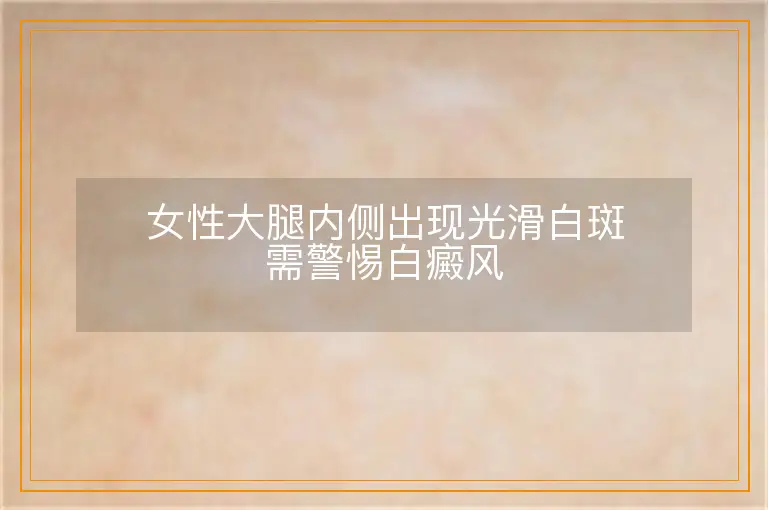 女性大腿内侧出现光滑白斑需警惕白癜风