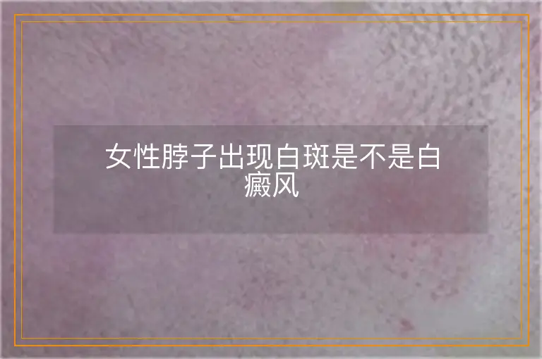 女性脖子出现白斑是不是白癜风