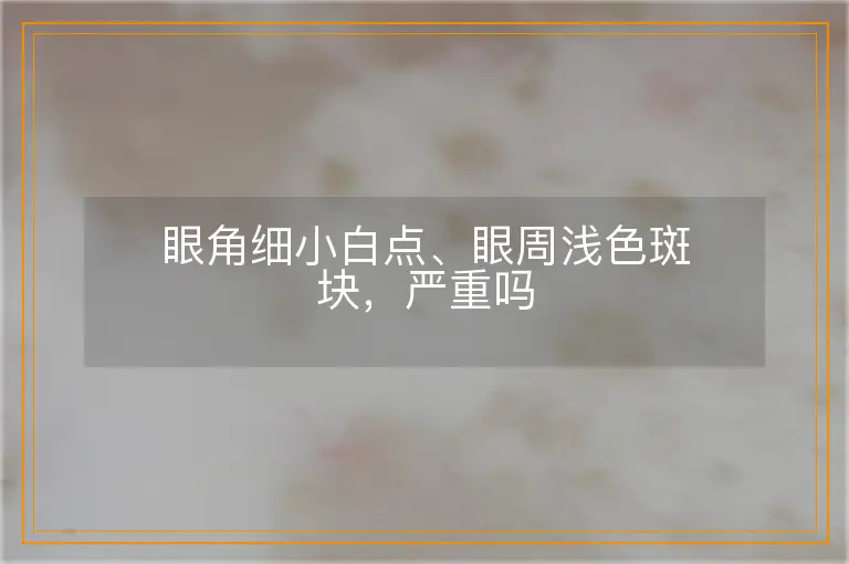 眼角细小白点、眼周浅色斑块,严重吗