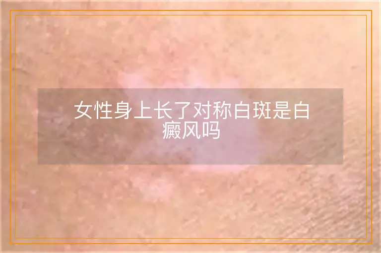 女性身上长了对称白斑是白癜风吗