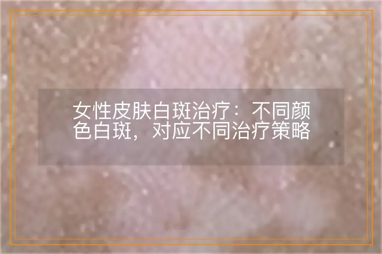 女性皮肤白斑治疗：不同颜色白斑，对应不同治疗策略