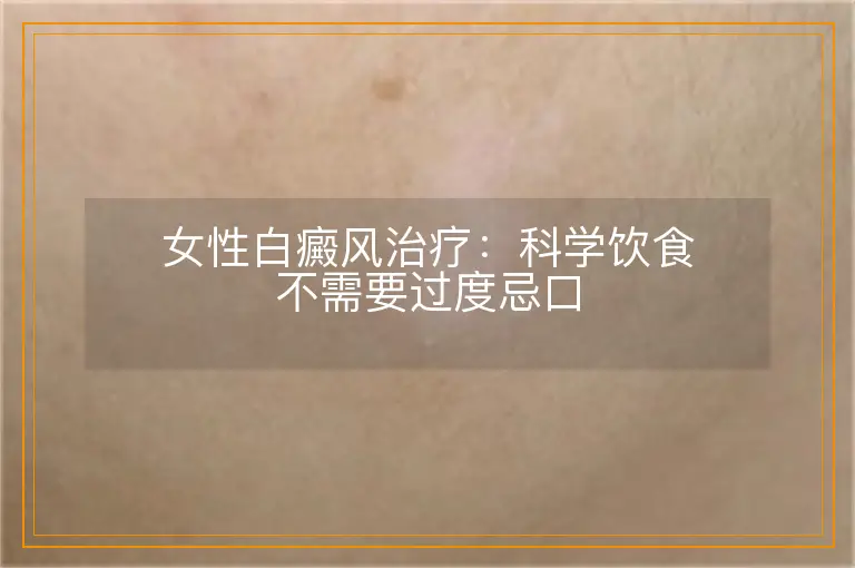 女性白癜风治疗:科学饮食不需要过度忌口