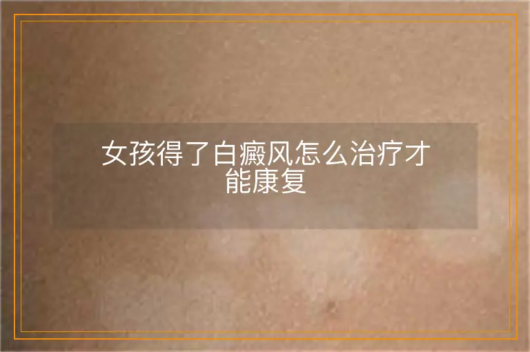 女孩得了白癜风怎么治疗才能康复