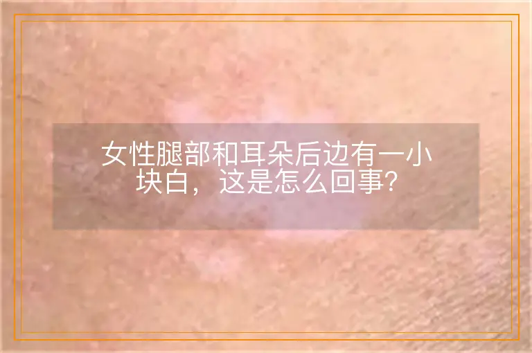 女性腿部和耳朵后边有一小块白,这是怎么回事?