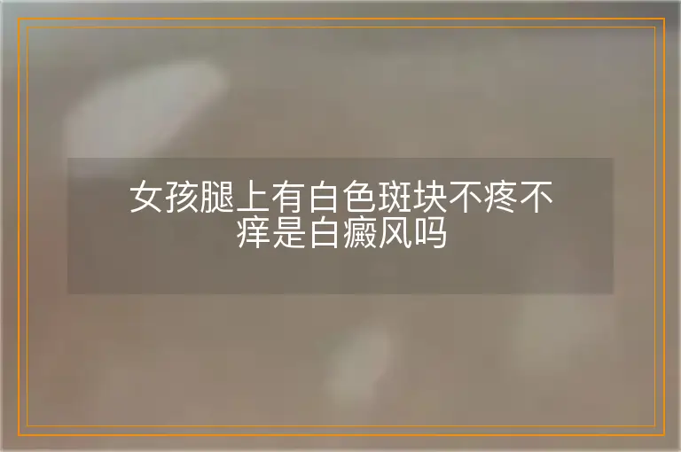 女孩腿上有白色斑块不疼不痒是白癜风吗