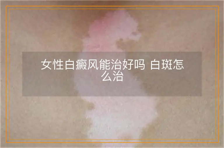 女性白癜风能治好吗 白斑怎么治