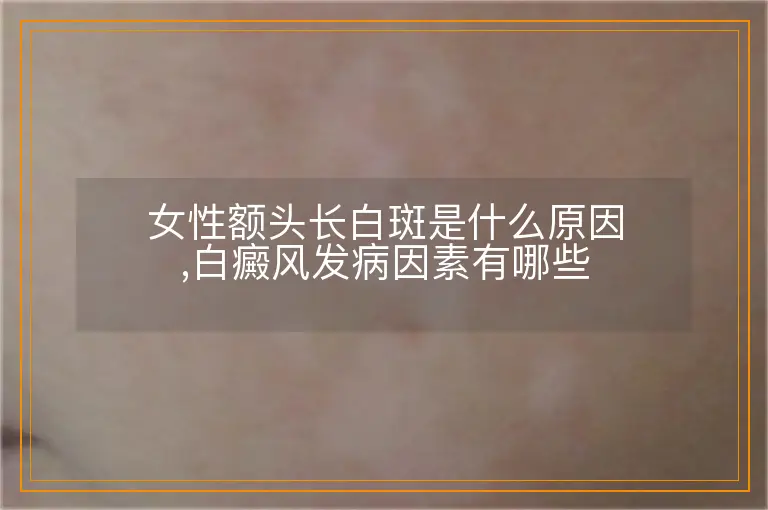 女性额头长白斑是什么原因,白癜风发病因素有哪些