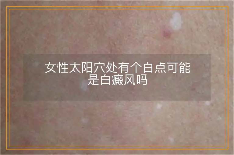 女性太阳穴处有个白点可能是白癜风吗