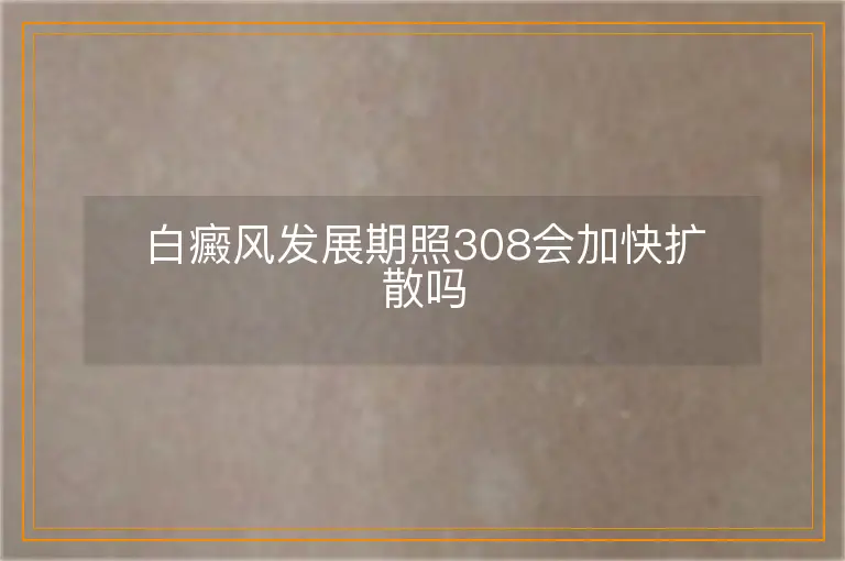 白癜风发展期照308会加快扩散吗