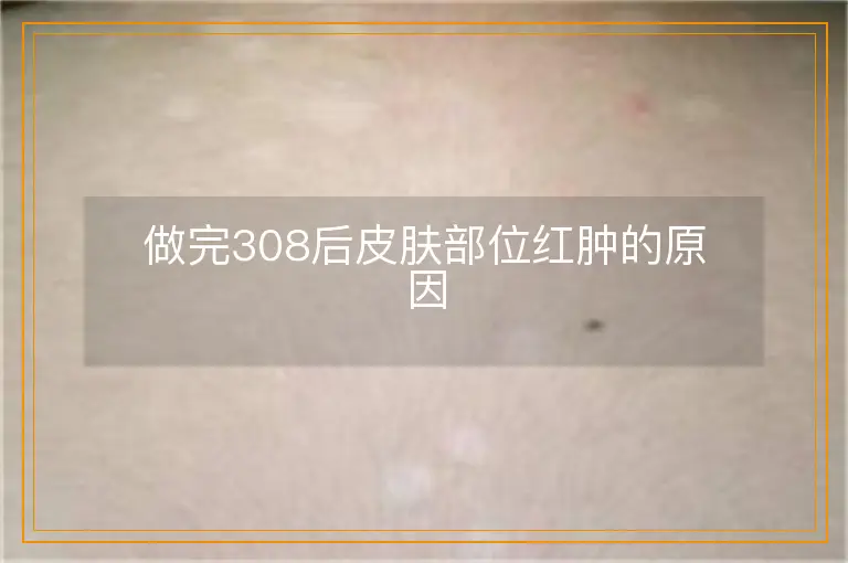 做完308后皮肤部位红肿的原因