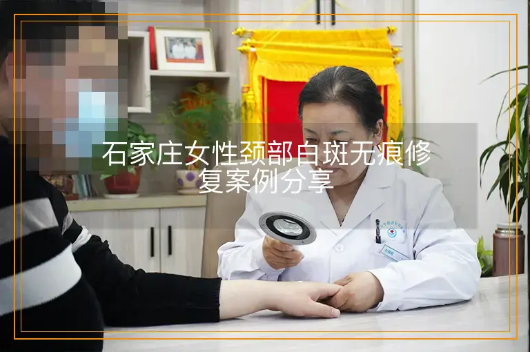 石家庄女性颈部白斑无痕修复案例分享