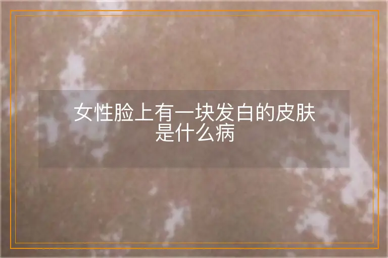 女性脸上有一块发白的皮肤是什么病