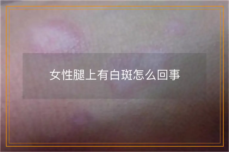 女性腿上有白斑怎么回事