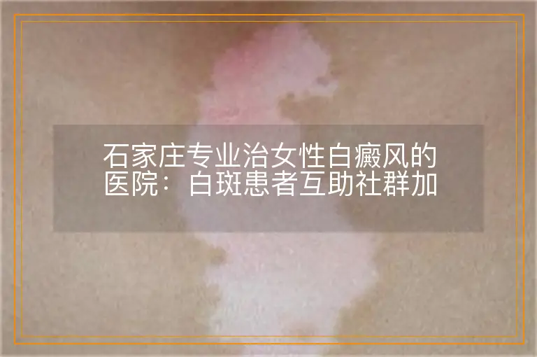 石家庄专业治女性白癜风的医院：白斑患者互助社群加入方式