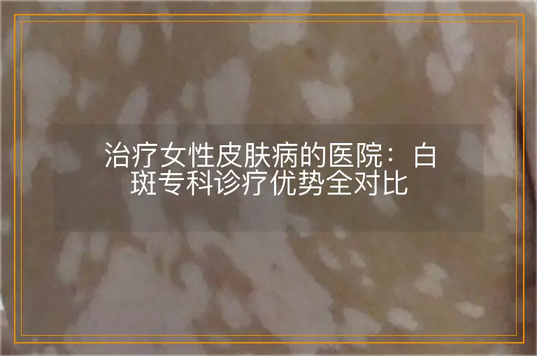 治疗女性皮肤病的医院:白斑专科诊疗优势全对比