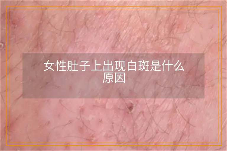 女性肚子上出现白斑是什么原因