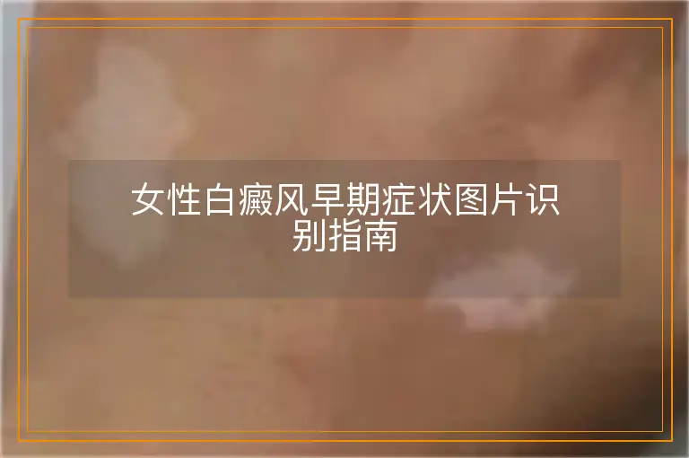 女性白癜风早期症状图片识别指南