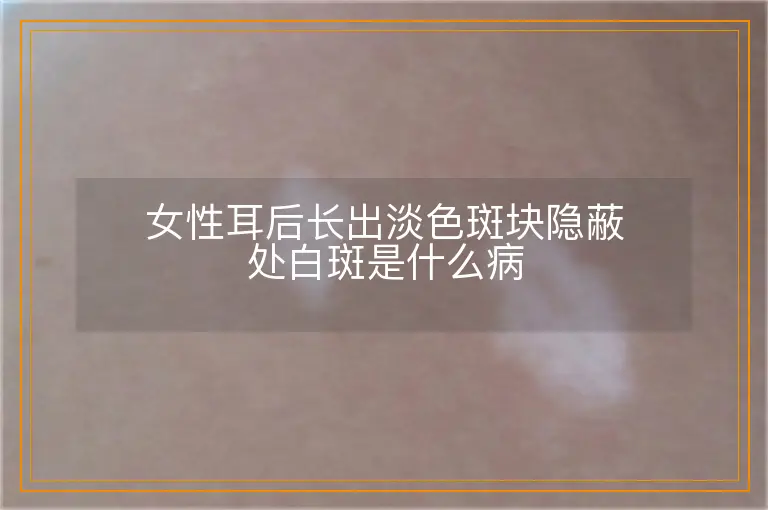 女性耳后长出淡色斑块隐蔽处白斑是什么病